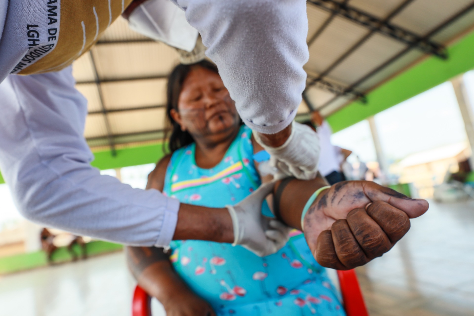 Indígena Kayapó recebe atendimento médico.