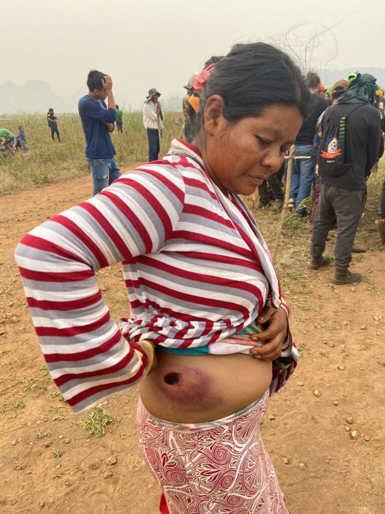 A Guarani Kaiowá Marli Gomes foi atingida por tiro de bala de borracha na ação de 12 de setembro da PM de Mato Grosso do Sul à Terra Indígena Nhanderu Marangatu (Foto: Renato Santana/Cimi)