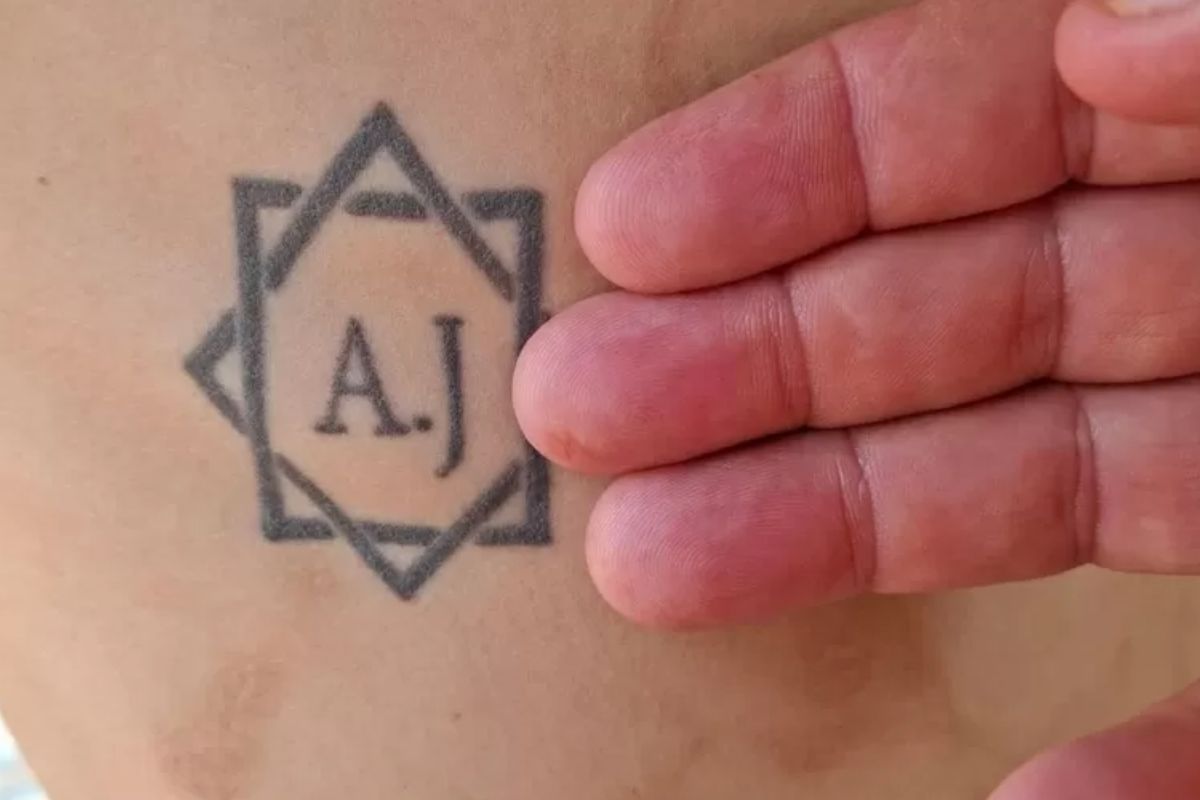 Tatuagem feita no corpo de vítima do trabalho escravo com iniciais dos nomes dos patrões. Depois, ela foi removida (Foto: Inspeção do Trabalho)